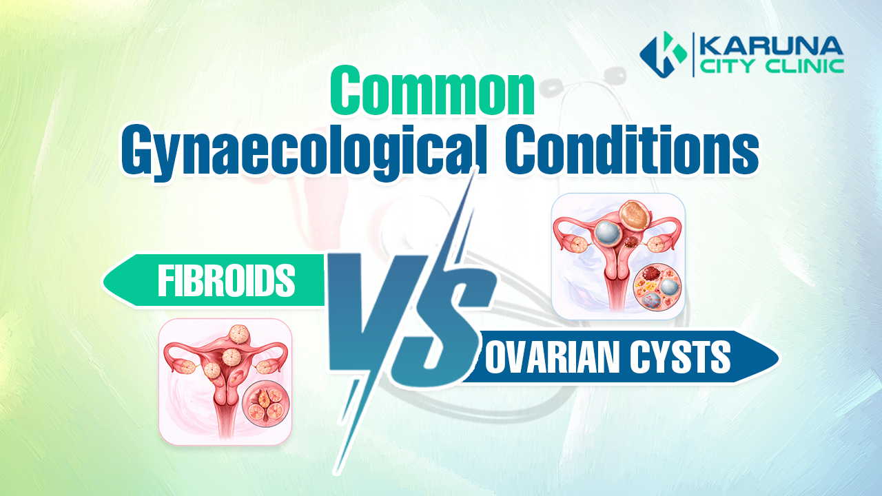 Fibroids Cysts
